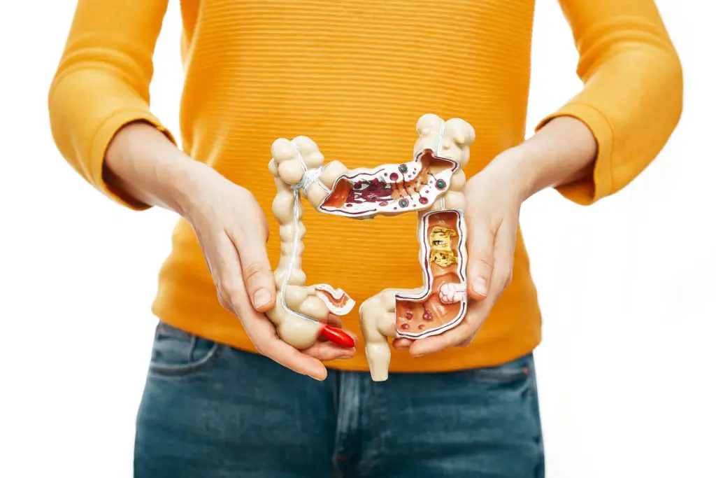 10-foods-for-colon-health-improve-your-digestive-health-fermenters